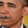 Một con ruồi đậu trên mép Tổng thống Mỹ Barack Obama khi ông đang phát biểu tại Nhà Trắng. Ảnh: AP. 