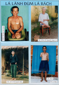 hoiban thuongphebinh 1